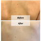 view of before and after skin healing